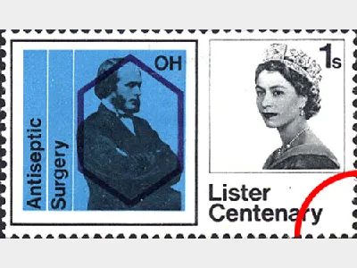 Antiseptic Surgery: 1s